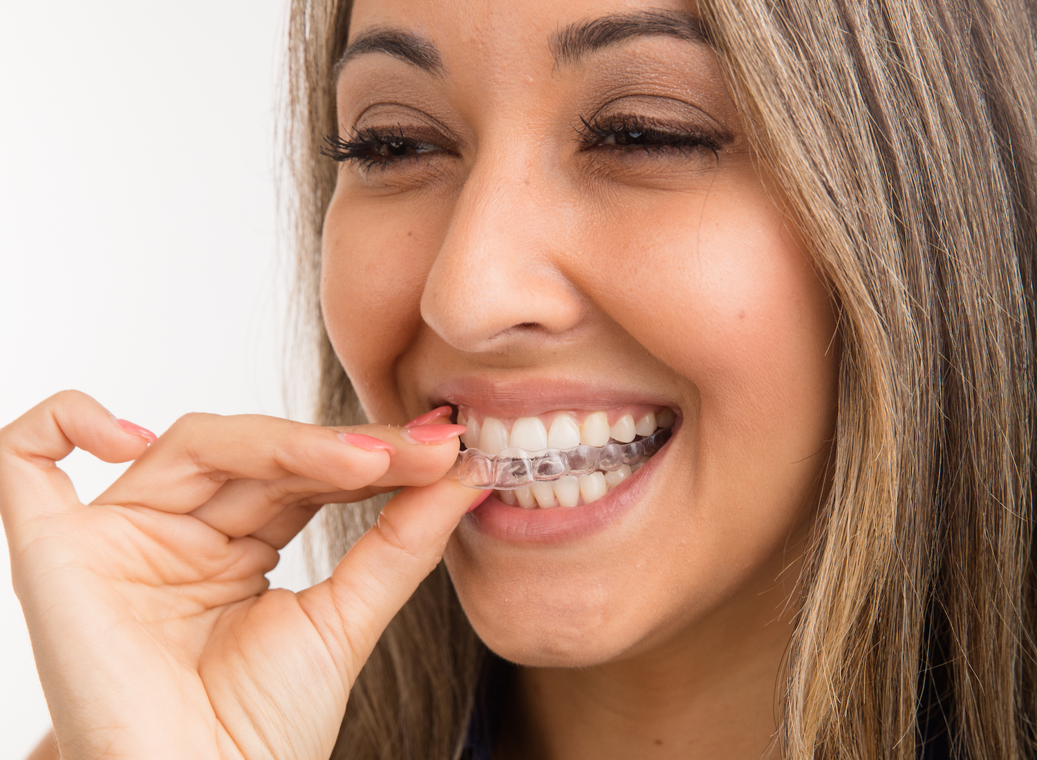 Affordable, doctor driven, straight teeth Simple Aligners