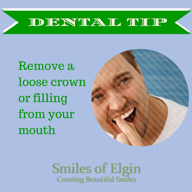 What Should You Do When Crown Comes Off Of Tooth