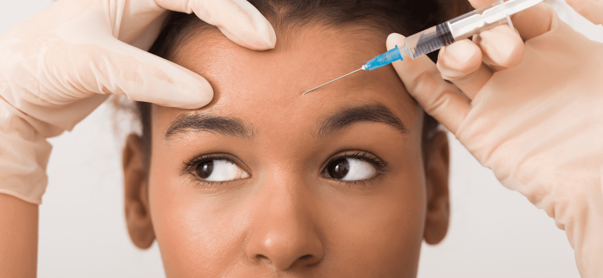 How Long Does Botox Last? What You Need to Know