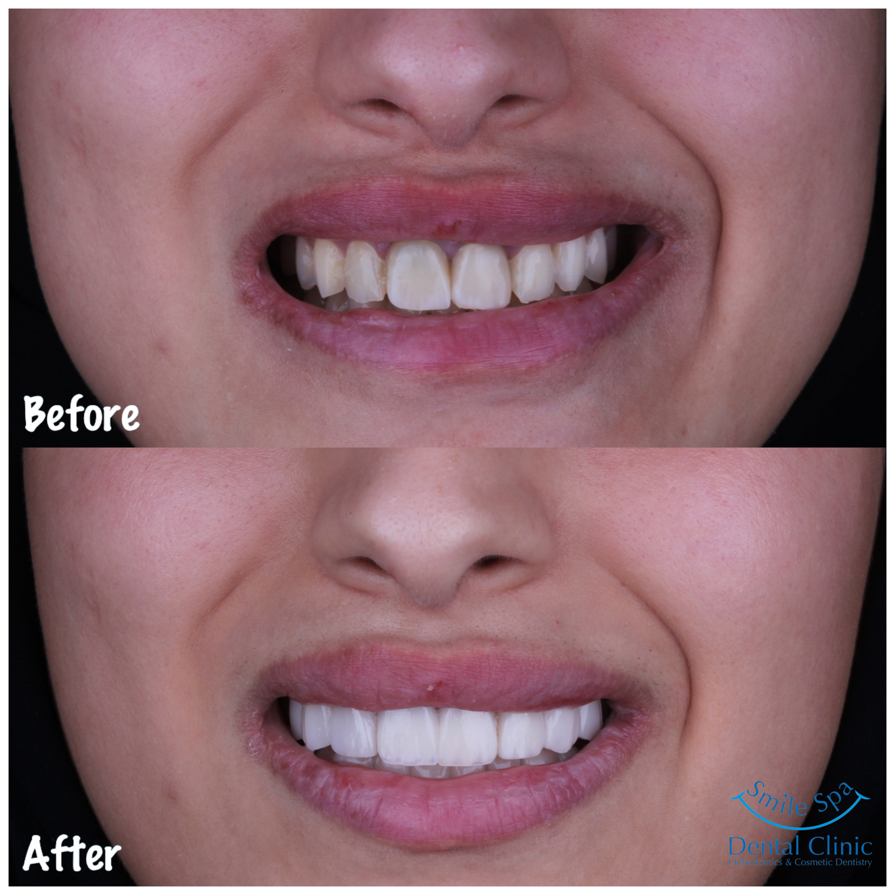 Gallery Smile Spa Dental Clinic