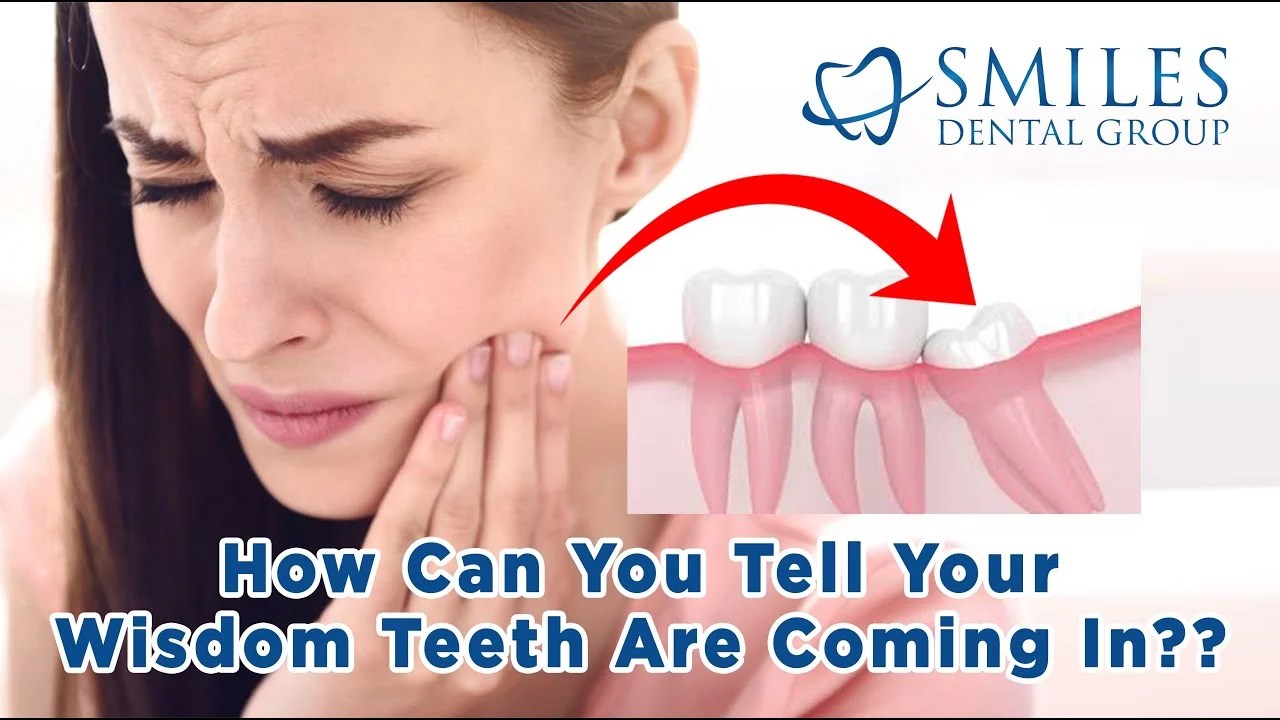 Wisdom Teeth Smiles Toothache