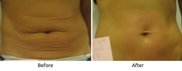 SMITHFIELD AESTHETICS Skin Rejuvenation, body contouring, feminine