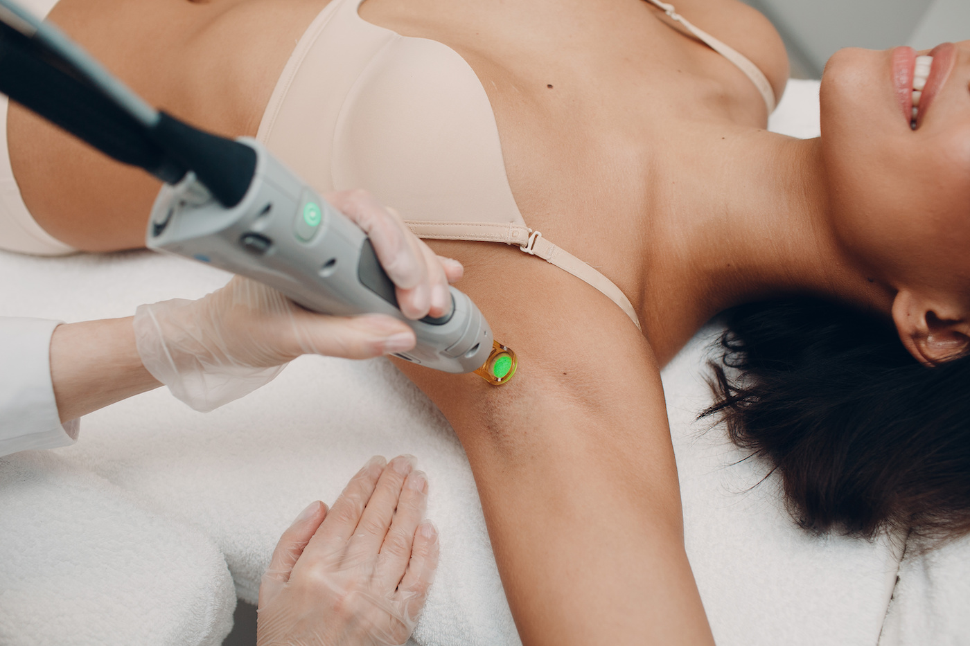 Does Laser Hair Removal Have Side Effects? SMooth Solutions Medspa