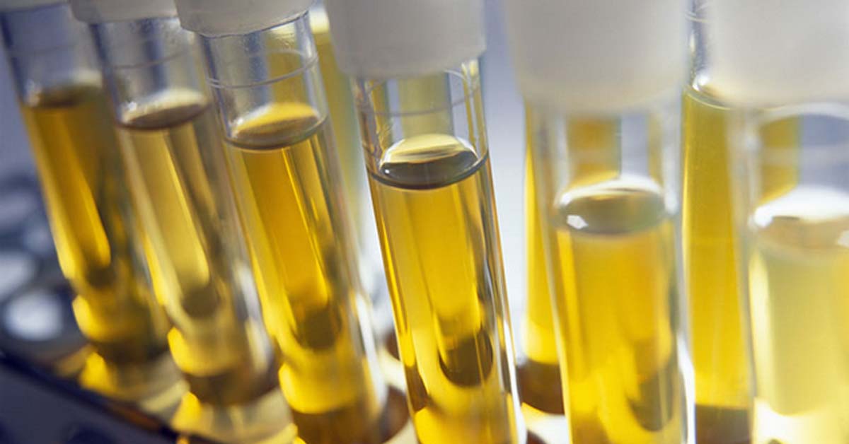 Study Food Allergy Diagnosed Via Urine