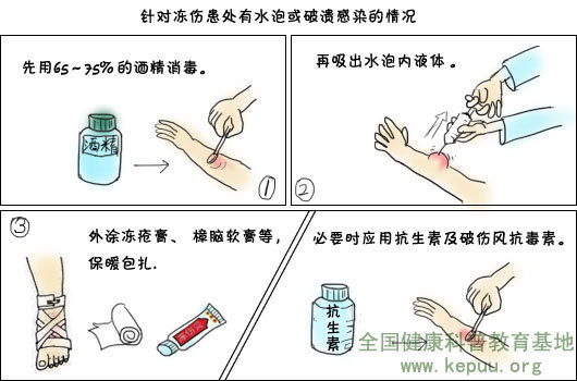 冻伤急救法_360百科