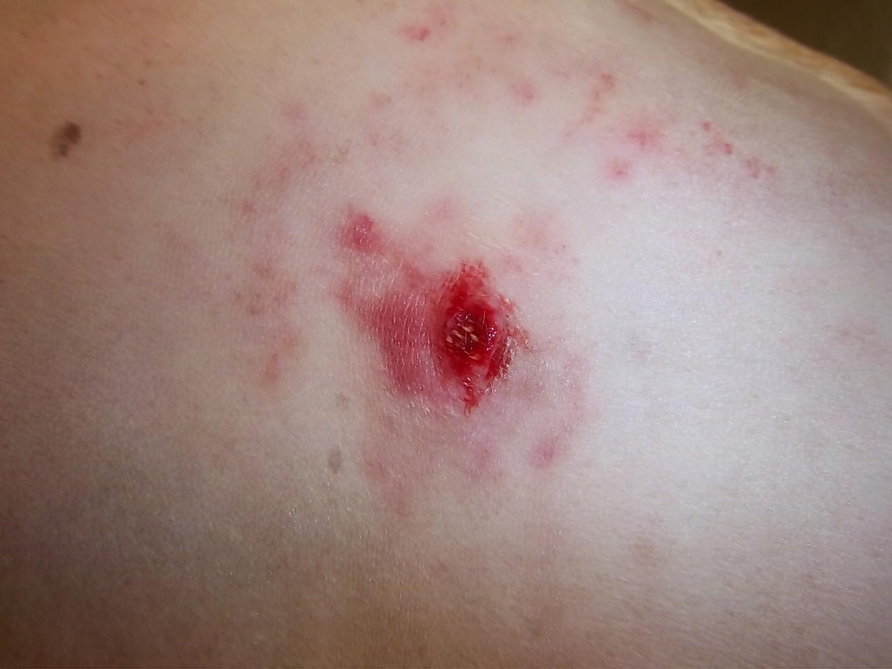 Cutaneous Mast Cell Tumors in Dogs Welland Animal Hospital