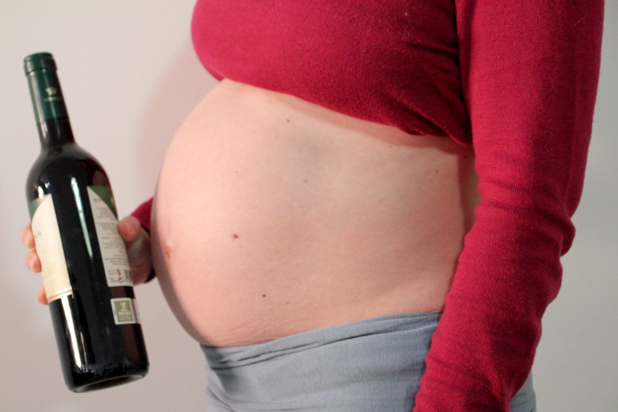 Socidrogalcohol El consumo de alcohol en el embarazo se relaciona con