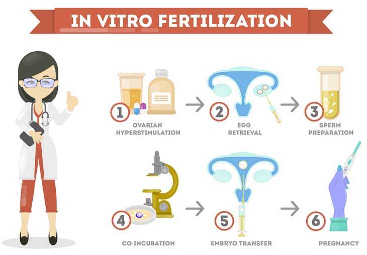 IVF Treatment Procedure or Test Tube Baby Process Step to Step