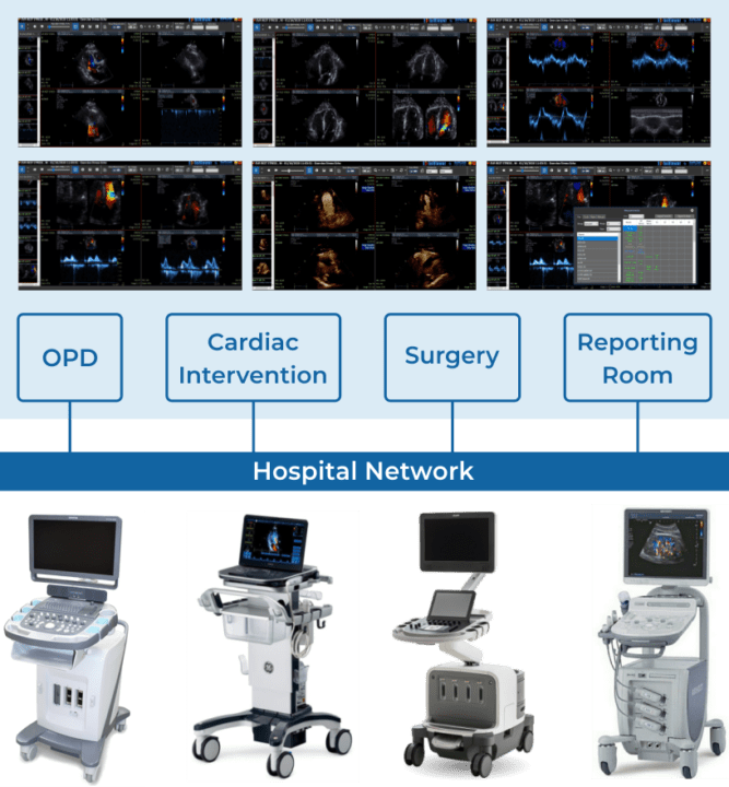 Echo PACS SoftLink International