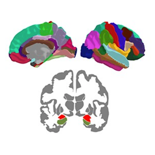 Multiplex Connectome Changes across the Alzheimer’s Disease Spectrum