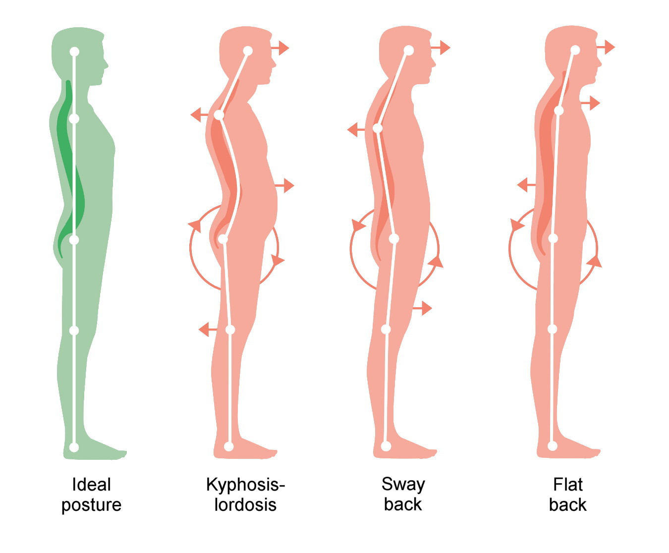 Fix Forward Head Posture with Pandiculation Somatic Movement Center