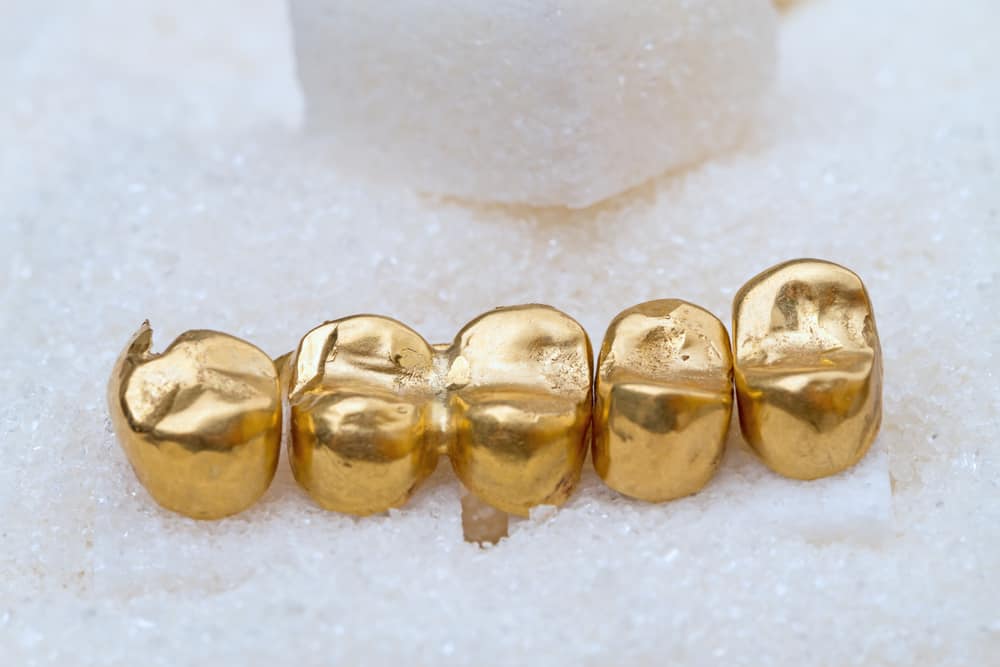How Much Does Permanent Gold Teeth Cost? (Chart)
