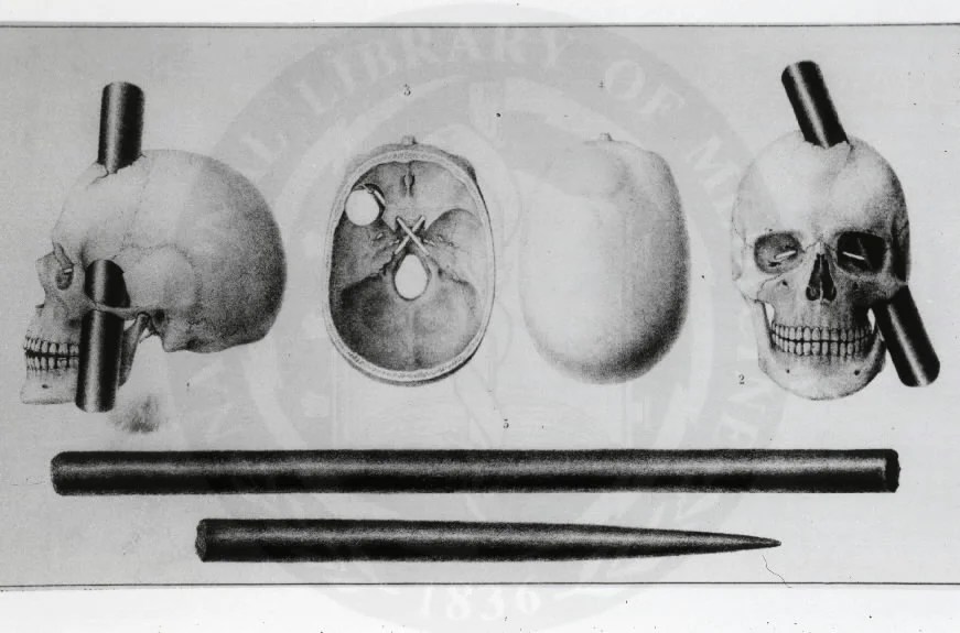 Medical Firsts The Story of Phineas Gage Sometimes Interesting