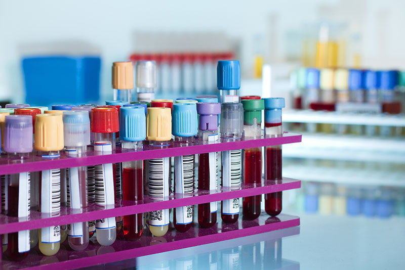 Negligent Mislabeling of Medical Lab Specimens Can Have Devastating