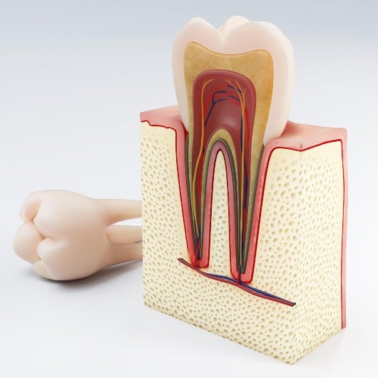 Root canal vs Crown differences and benefits of each Somos Dental