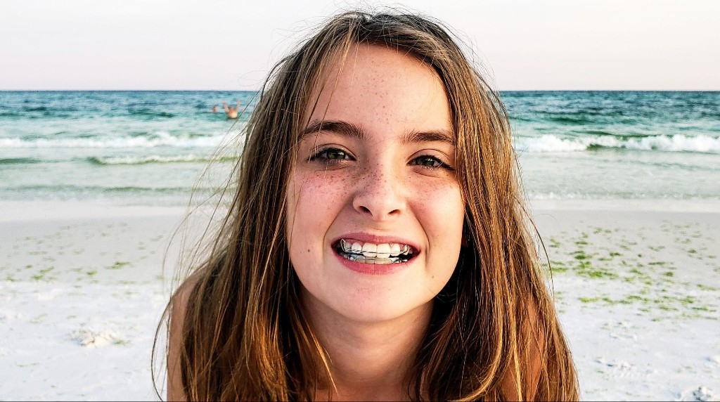 What are orthodontic retainers? How do they work? Somos Dental