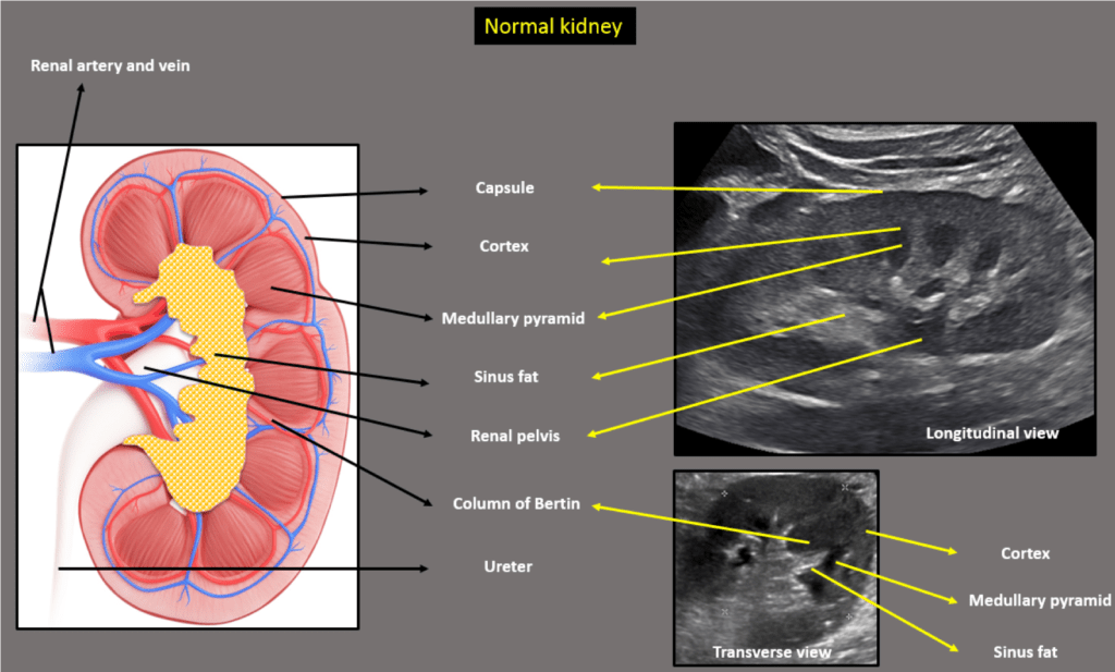 Kidney Ultrasound SONOSIF by SIFSOF, California