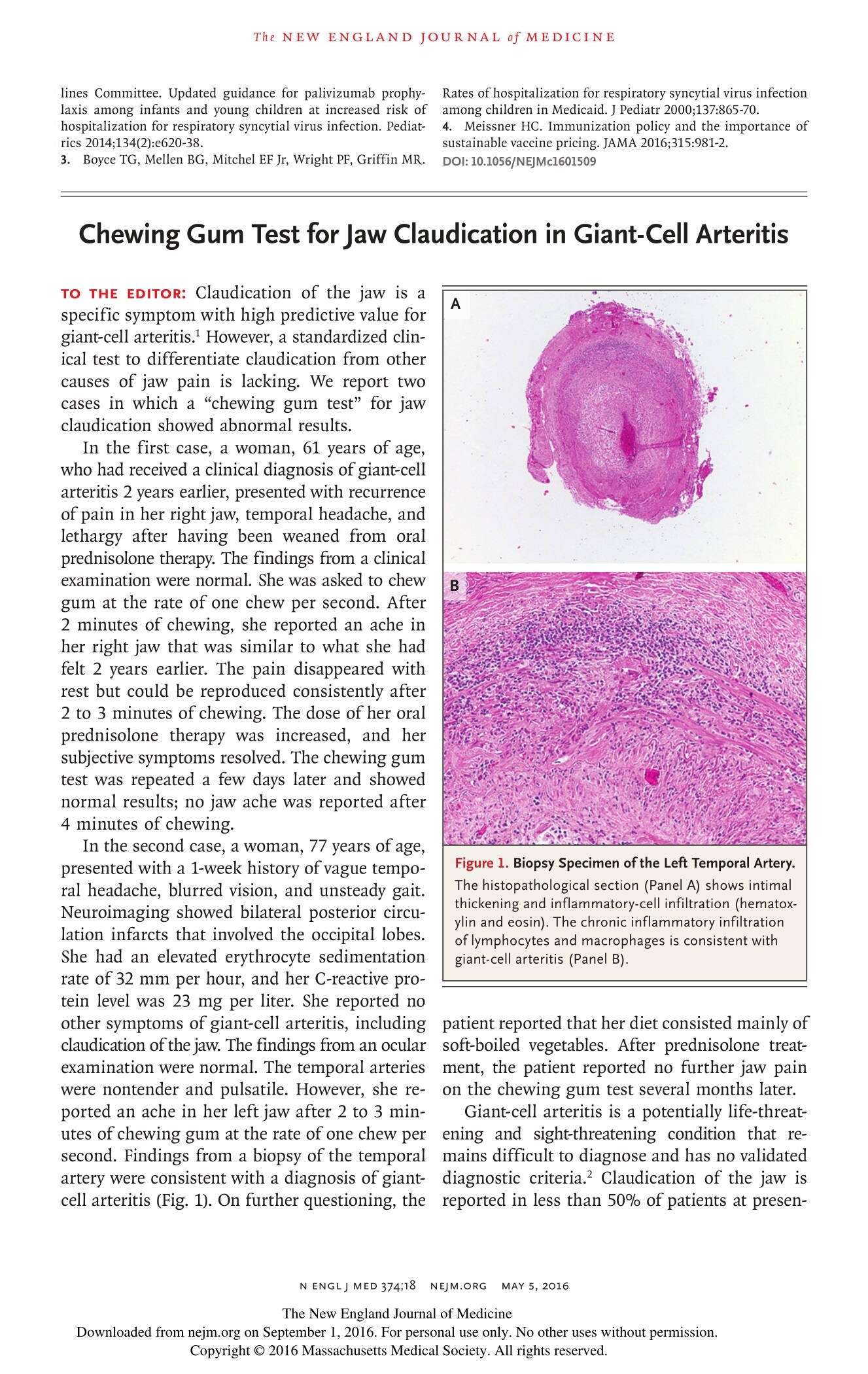 Neuro Ophthalmologist Dr Clare Fraser publishes in the New England