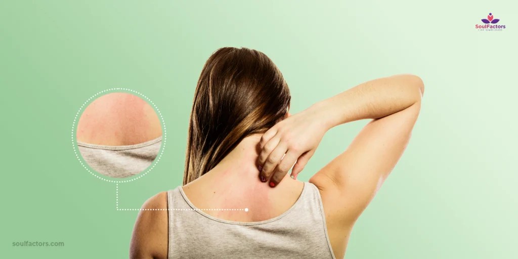 14 Effective Yet Curable Home Remedies For Itchy Skin!