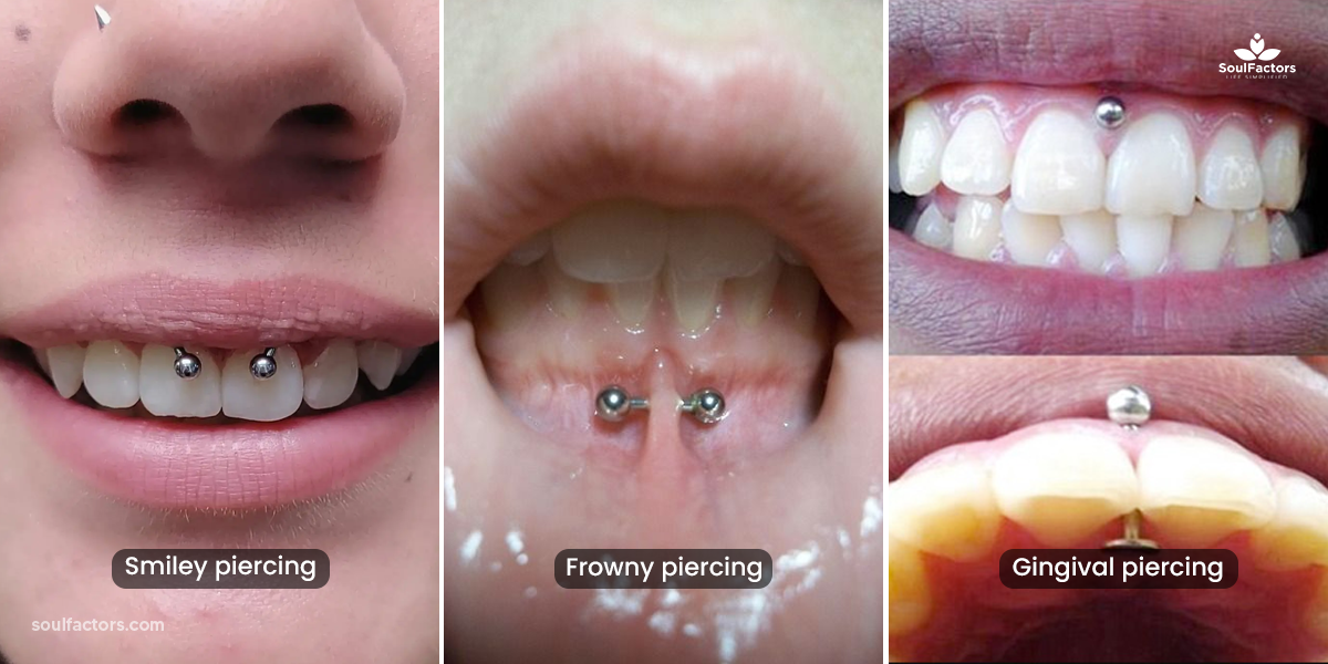 Gum Piercing Exploring The Unique Oral Body Modification Trend!