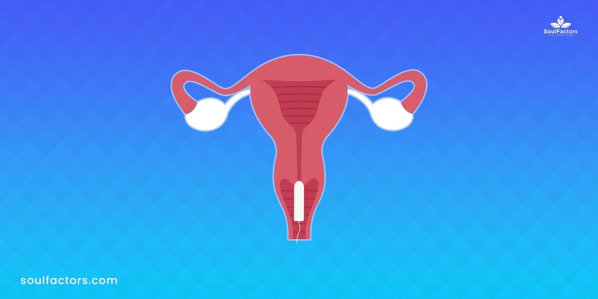 I Can't Remember if I Took My Tampon Out Here's What to Do