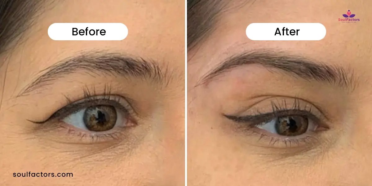 Eyebrow Thread Lift The Secret To Effortlessly Perfect Arches!