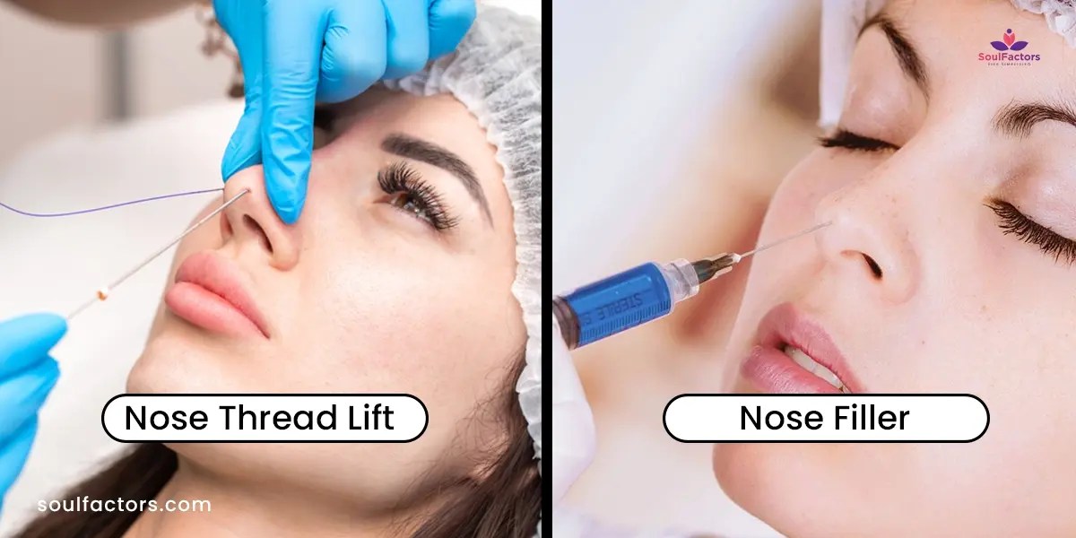 Nose Thread Lift Discovering Benefits And Understanding Risks!