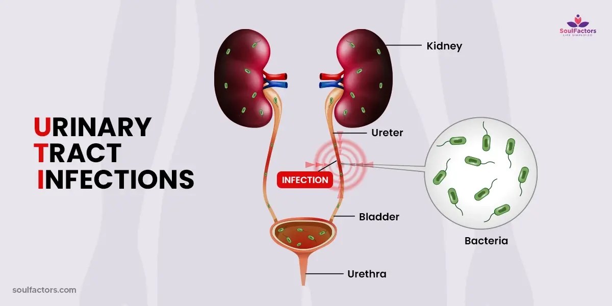Yeast Infection Vs UTI Understanding the Difference!