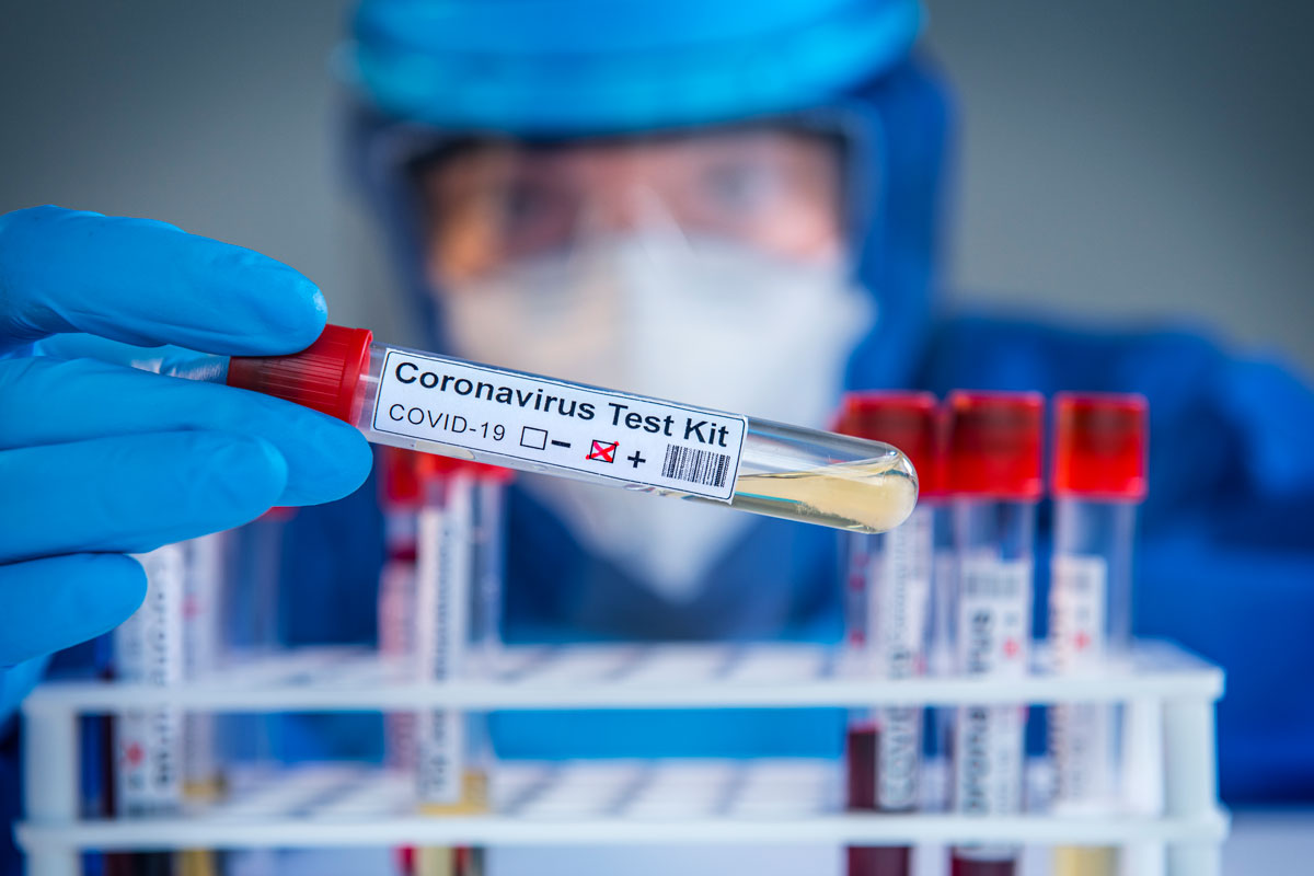 Washington University, St. Louis County collaborate on COVID19 survey The Source Washington