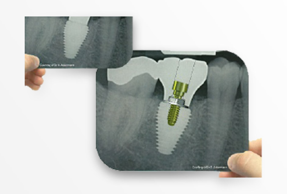 Southern Implants, Dental Implant Treatment Solutions, Innovative