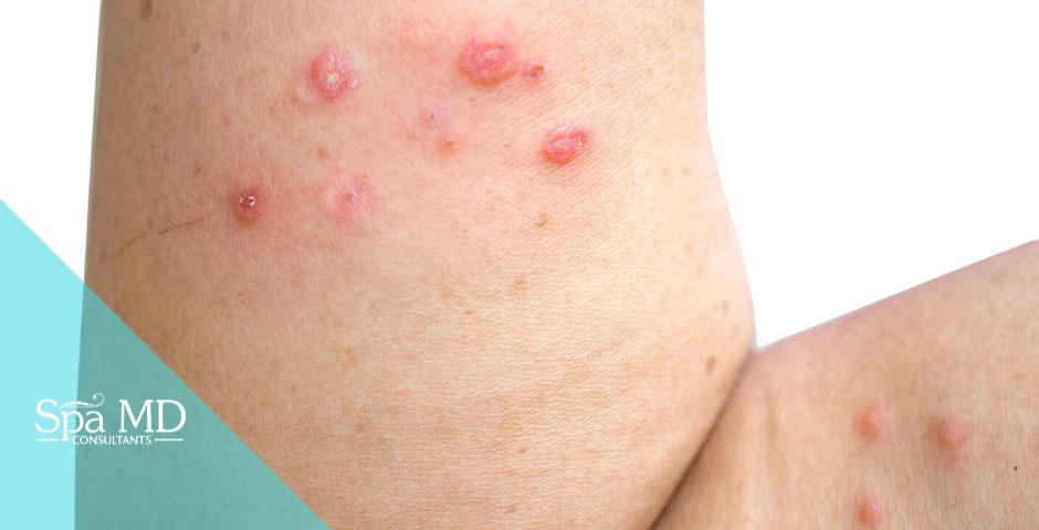 5 Most Common Skin Conditions (And How To Fight Them) - Spa Md