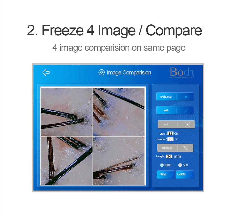 skin and hair analysis for hair scalp, follicle and skin pores analysis