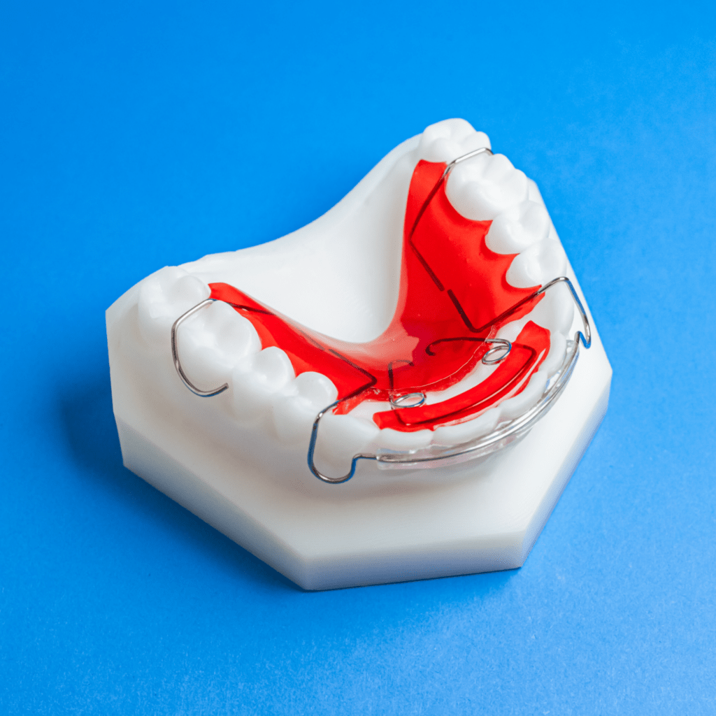 "Super" Modified Spring Retainer Specialty Appliances