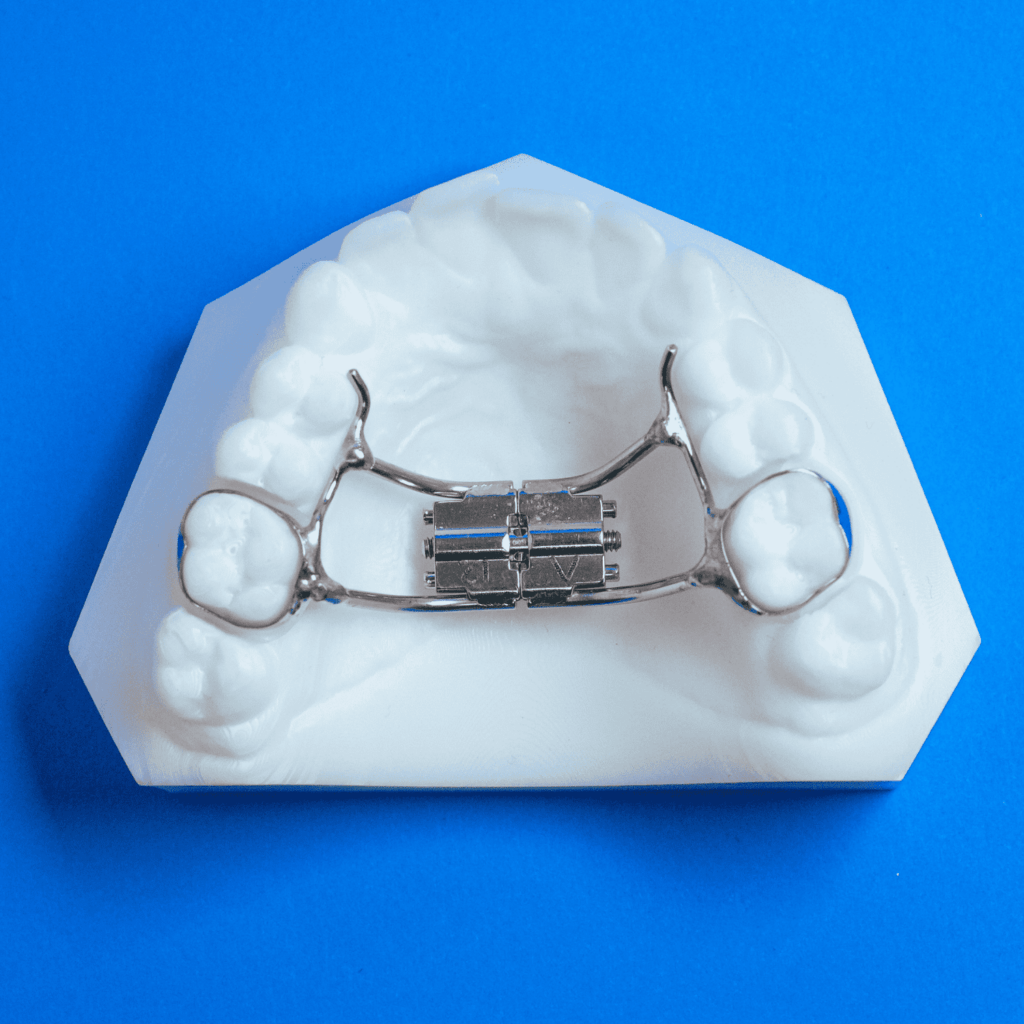 Upper RPE Specialty Appliances