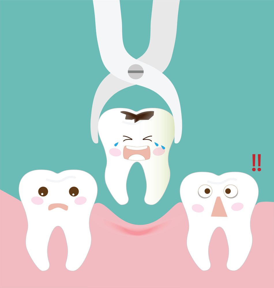 Reasons Why Tooth Extraction Procedure May Be Necessary