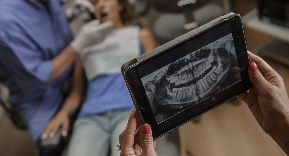 Exploring the Role of Digital Xrays in Enhancing Dental Diagnosis