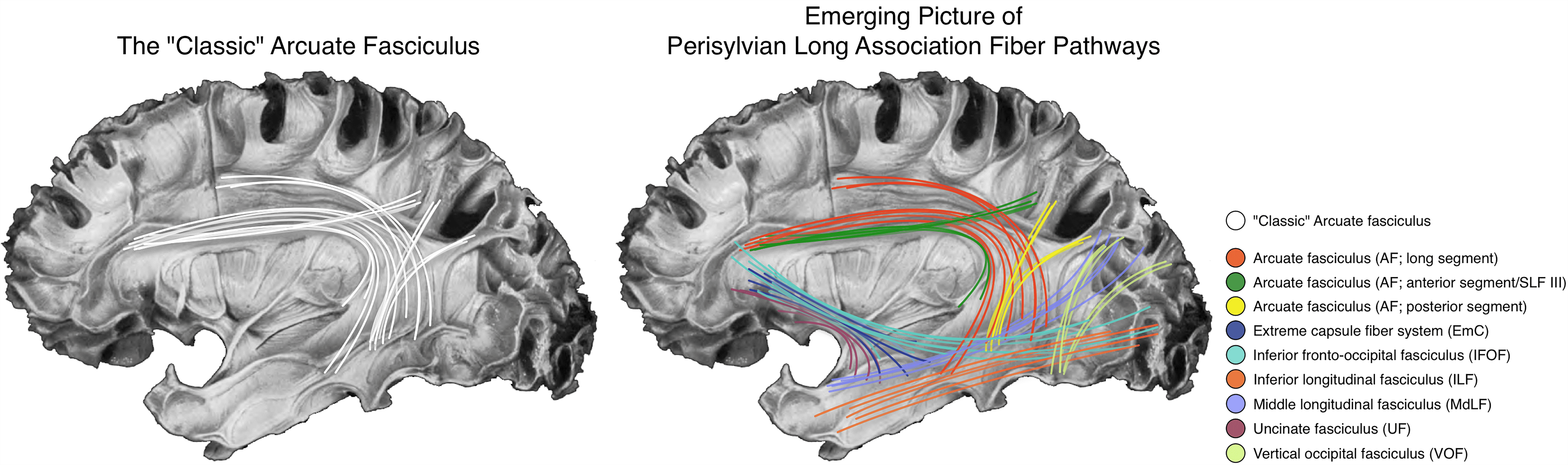 Podcast with Dr. Tremblay Speechneurolab