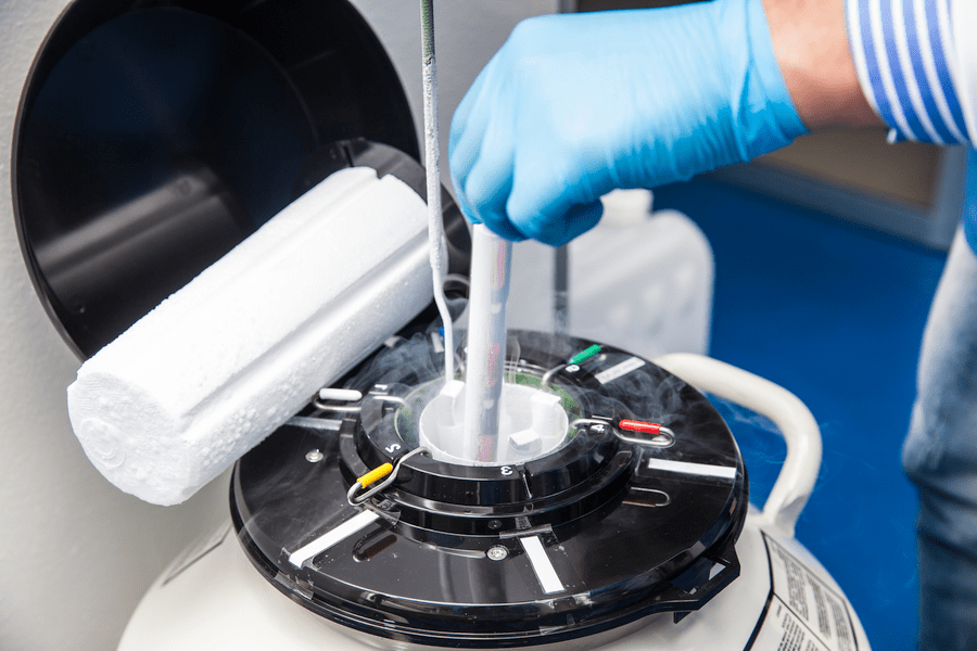 What You Need to Know About Freezing Sperm