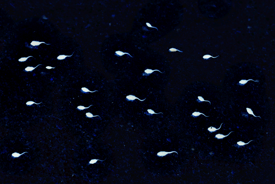 How Long Does Sperm Live Outside the Body?