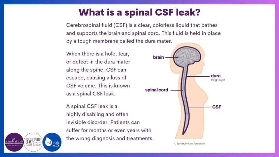 LeakWeek 2023 Day One Spinal CSF Leak Foundation(04)