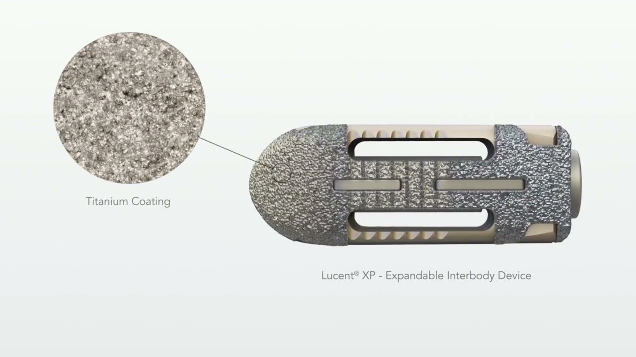 Lucent XP® Spinal Elements