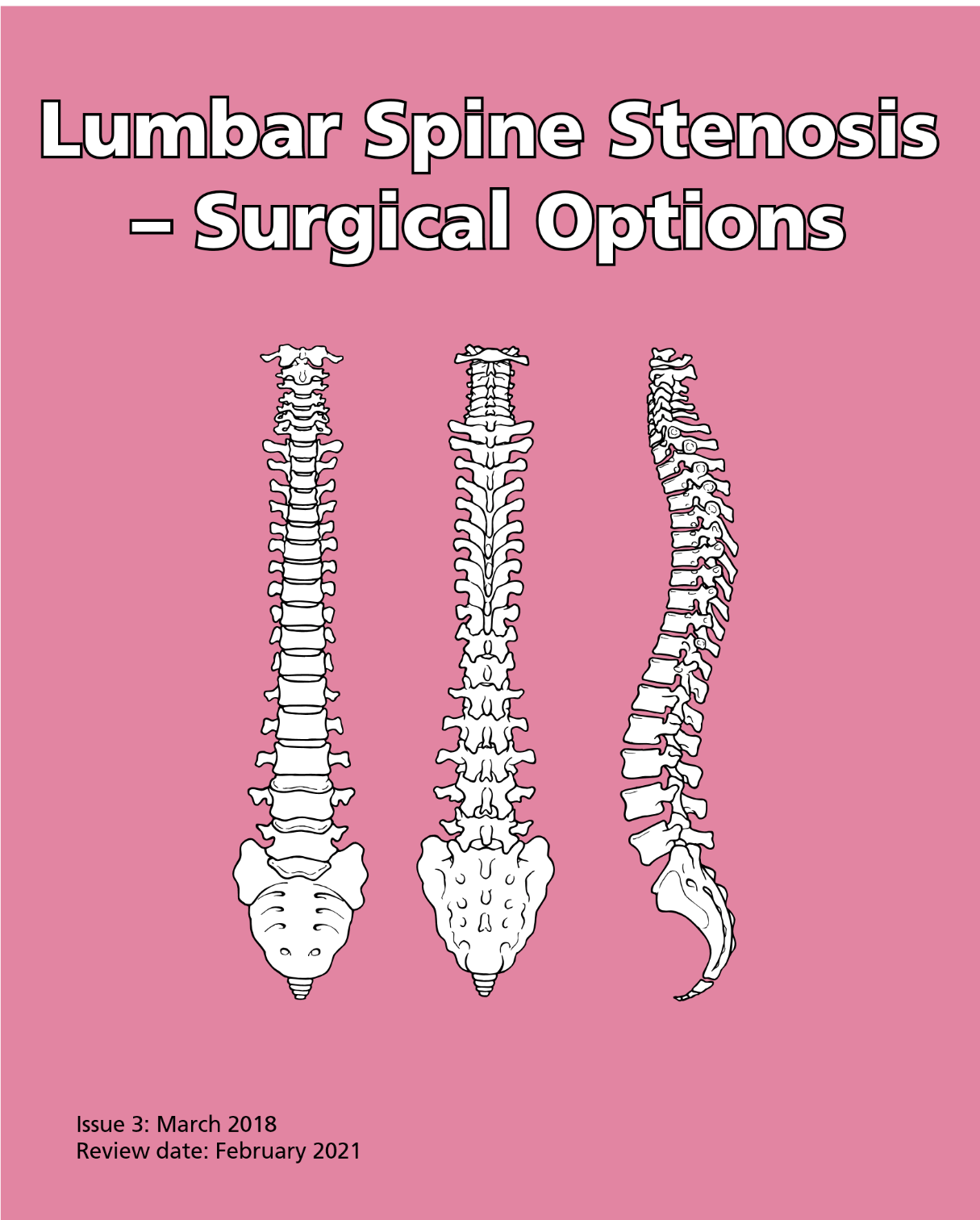 Lumbar Spine Stenosis Surgical Options Spine and Brain