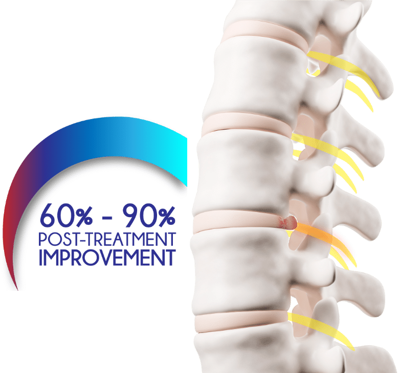 Facet Joint Osteoarthritis Causes, Symptoms and Treatments
