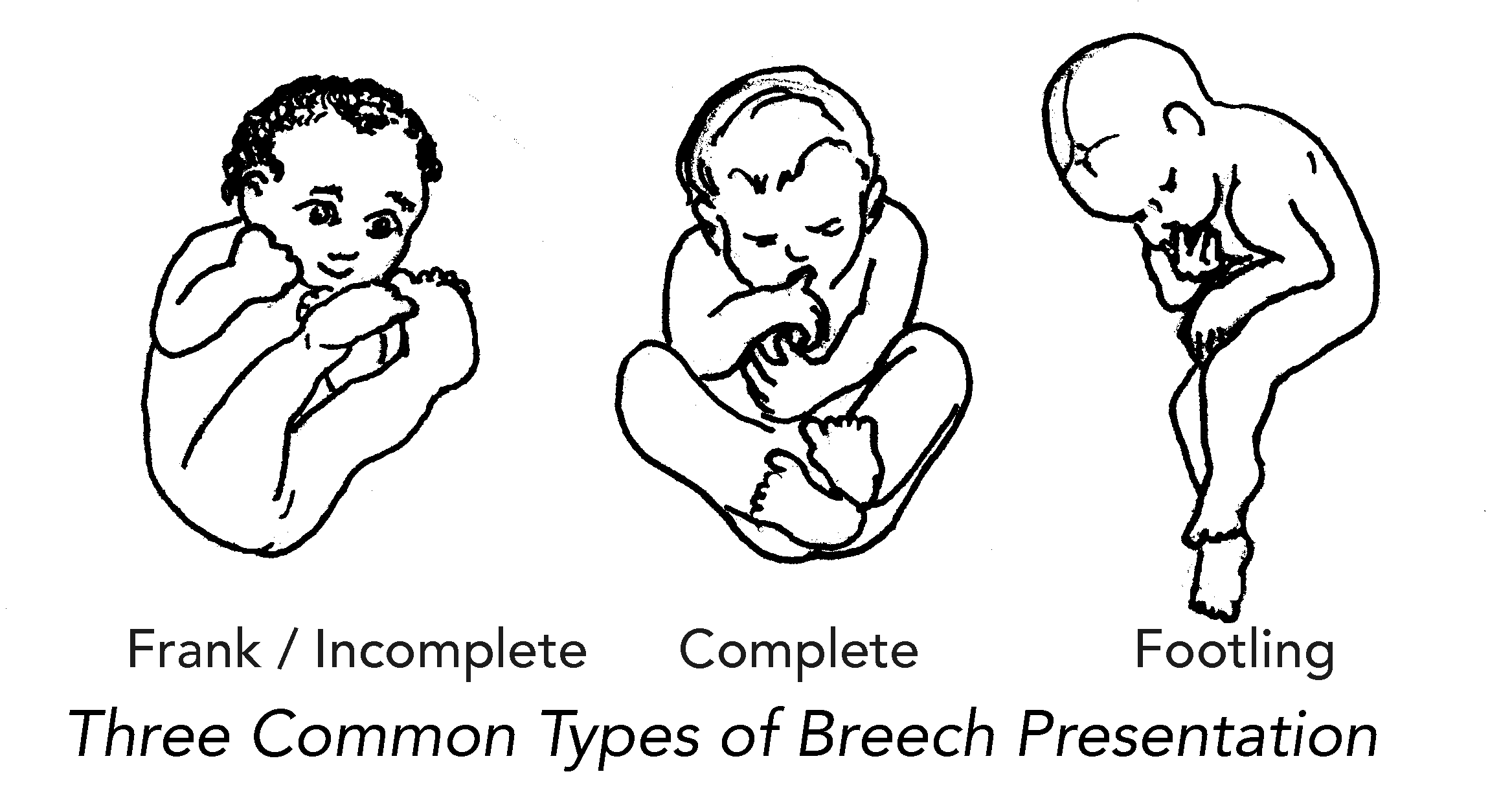 Breech
