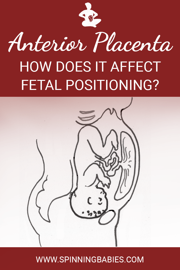 Anterior Placenta What It Means for You and Your Baby Spinning Babies