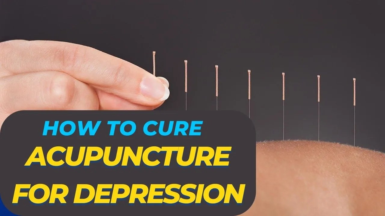 10 effective benefit of Acupuncture points for depression everything you need to kno
