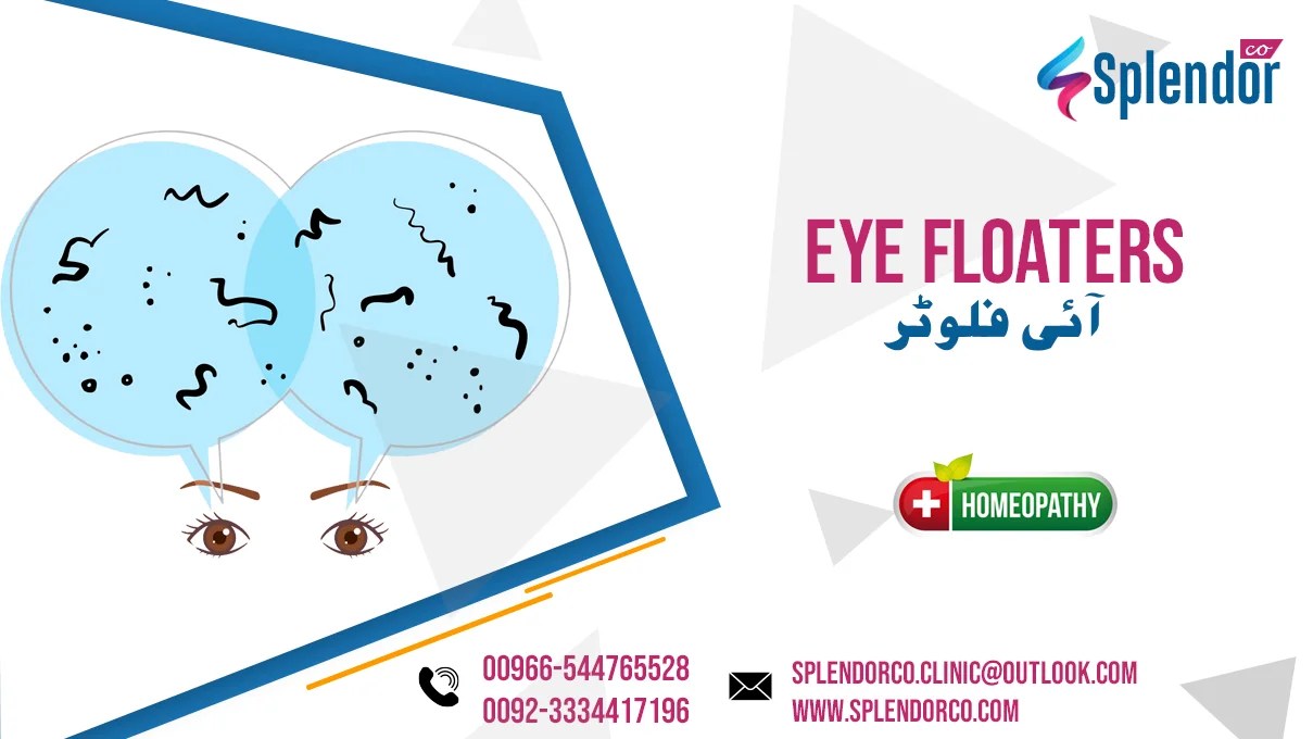 Homeopathic Remedies for Eye Floaters