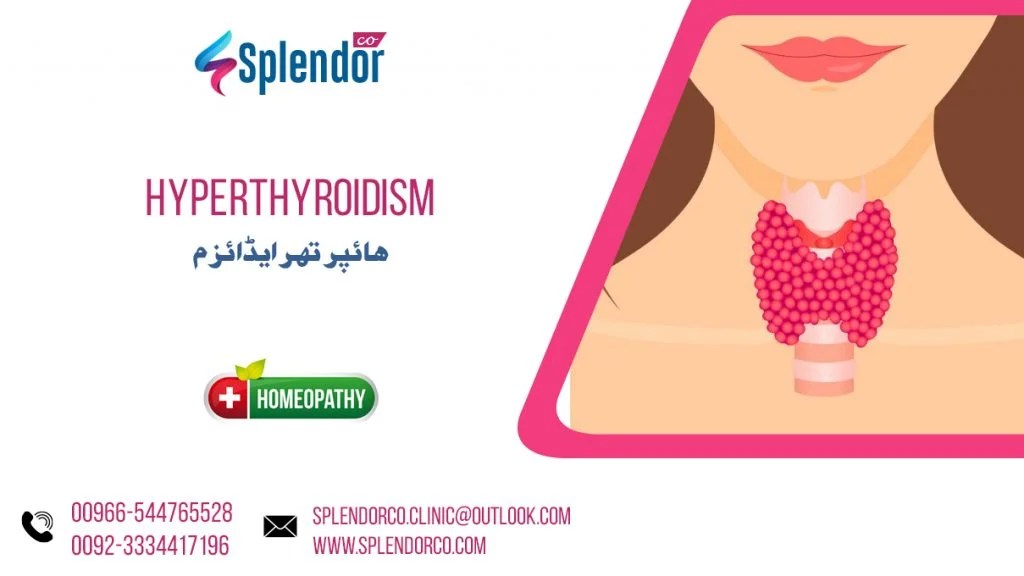 Homeopathic Medicines for Hyperthyroidism Goitre and Graves Disease