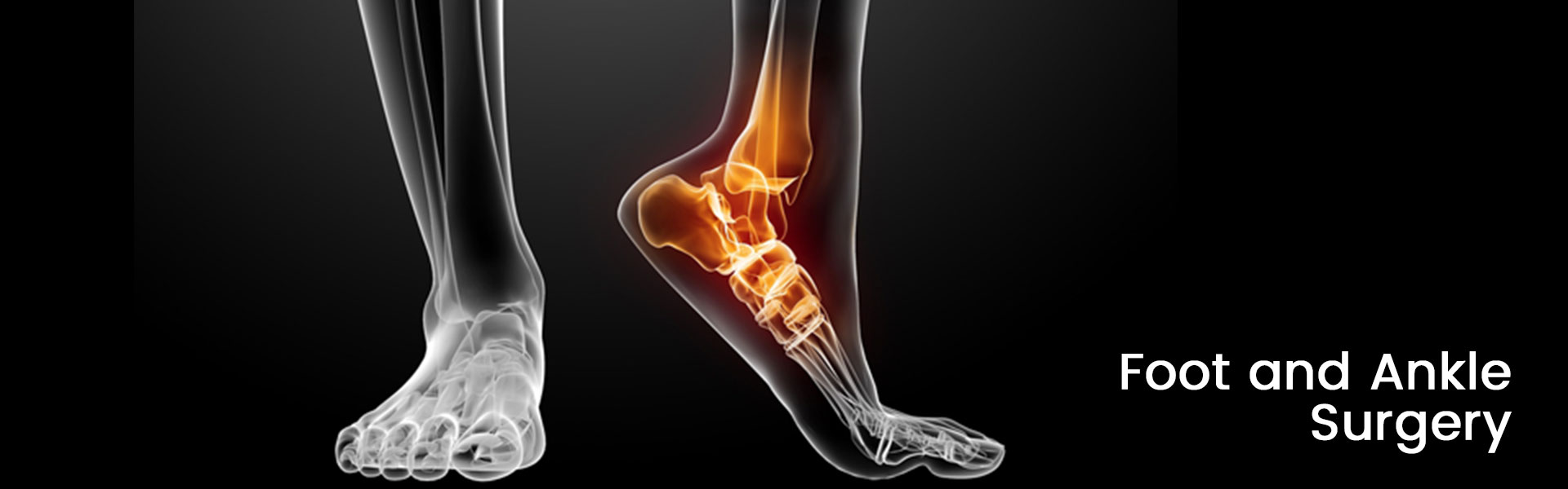 Foot and Ankle Surgery