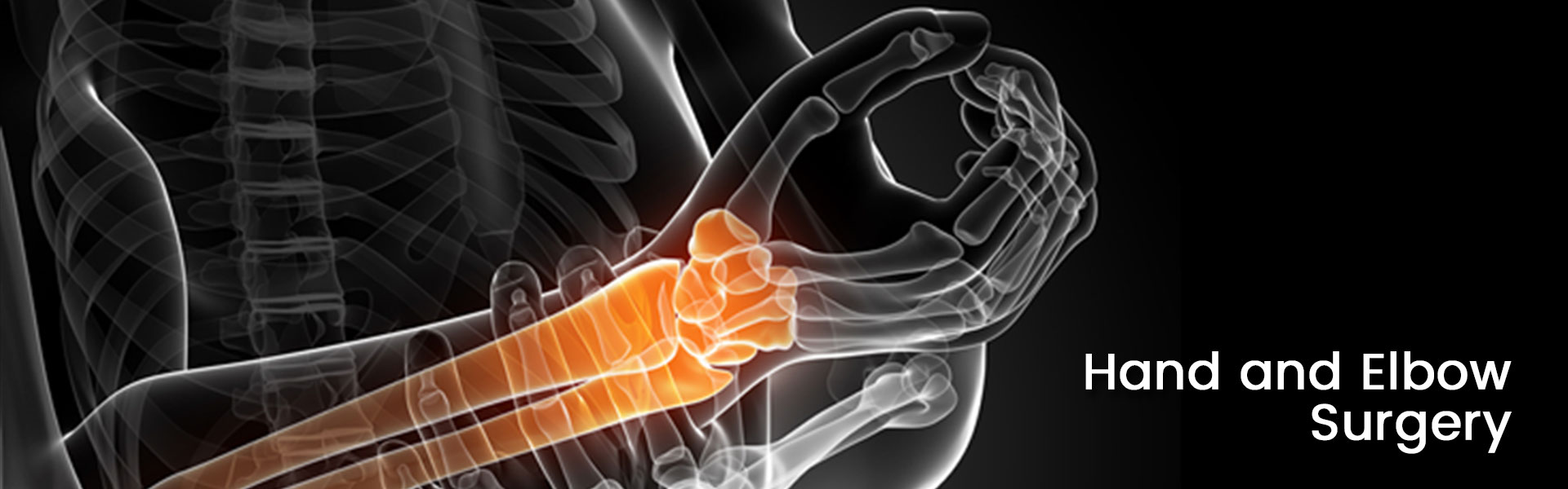 Hand and Elbow Surgery